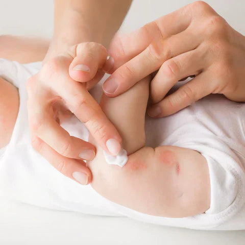 Baby Skincare 101: Essential Treatments & Solutions