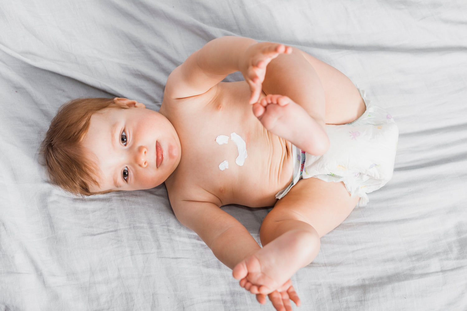 Diaper Rash Prevention: Expert Tips from Pediatricians